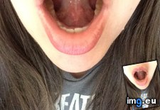 Tags: born, bottom, connecting, frenulum, mouth, tongue (Pict. in My r/MILDLYINTERESTING favs)