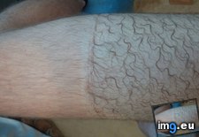 Tags: compression, hair, interesting, leg, mildly, mile, run, shorts (Pict. in My r/MILDLYINTERESTING favs)