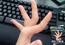 Tags: bend, fingers, way, wrong (Pict. in My r/MILDLYINTERESTING favs)