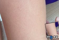 Tags: arm, circle, friends, grows, hair (Pict. in My r/MILDLYINTERESTING favs)