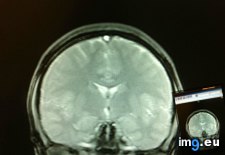 Tags: black, blowing, brain, kisses, man, mri, showed, small, suit (Pict. in My r/MILDLYINTERESTING favs)