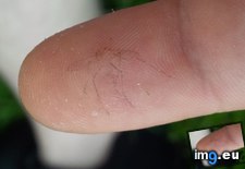 Tags: air, finger, imprint, moment, mosquito (Pict. in My r/MILDLYINTERESTING favs)