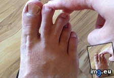 Tags: are, partially, toes, two, webbed (Pict. in My r/MILDLYINTERESTING favs)