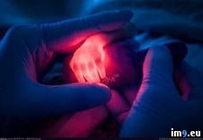 Tags: baby, hand, nurse, premature, vein (Pict. in My r/PICS favs)