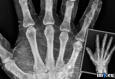 Tags: dipped, hand, iodine, radiograph, was (Pict. in My r/PICS favs)