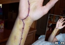 Tags: aft, ago, aneurysm, artery, interest, months, rest, showed, ulnar, wtf (Pict. in My r/WTF favs)