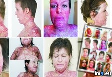 Tags: burns, dana, estranged, hands, horrific, innocent, jealous, suffered, vulin, wife, woman, wtf (Pict. in My r/WTF favs)