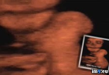 Tags: baby, deformed, nsfl, terrifying, ultrasound, wtf (Pict. in My r/WTF favs)
