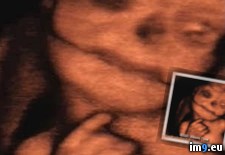 Tags: baby, deformed, nsfl, terrifying, ultrasound, wtf (Pict. in My r/WTF favs)
