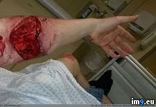 Tags: arm, clubbing, friend, heart, perfect, wtf (Pict. in My r/WTF favs)