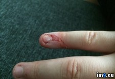 Tags: gore, hangnail, pulled, wtf (Pict. in My r/WTF favs)