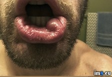 Tags: biting, get, habit, lip, mucocele, one, wtf, you (Pict. in My r/WTF favs)