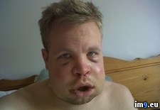 Tags: expected, had, jaw, operation, slightly, swelled, wtf (Pict. in My r/WTF favs)
