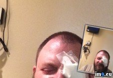 Tags: eye, surgery, wtf (Pict. in My r/WTF favs)
