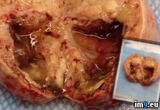 Tags: asked, delivered, ovarian, picture, ruler, scale, surgeon, wtf (Pict. in My r/WTF favs)