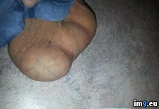 Tags: show, testicles, turned, waiting, wtf (Pict. in My r/WTF favs)
