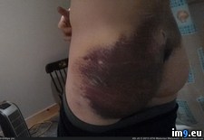 Tags: body, bruise, damage, feet, fell, friend, ledge, off, physical, rock, was, wtf (Pict. in My r/WTF favs)