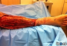 Tags: fasciitis, friend, had, necrotizing, stepdad, wtf (Pict. in My r/WTF favs)