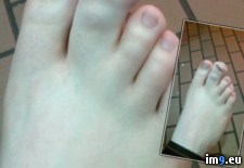Tags: friend, toe, wtf (Pict. in My r/WTF favs)