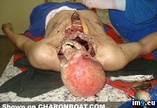 Tags: accident, aftermath, cut, nsfl, wtf (Pict. in My r/WTF favs)