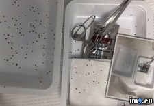Tags: bee, patient, pulled, stingers, wtf (Pict. in My r/WTF favs)
