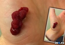 Tags: cut, decided, friend, needed, stitches, wtf (Pict. in My r/WTF favs)