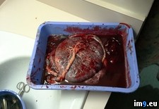 Tags: career, doctor, entire, midwife, nurse, person, photo, placenta, wtf (Pict. in My r/WTF favs)