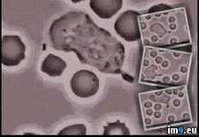 Tags: action, biology, human, immune, system, wtf (GIF in My r/WTF favs)