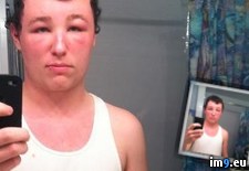Tags: allergic, dye, guy, hair, reaction, wtf (Pict. in My r/WTF favs)