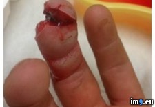 Tags: broke, buddies, finger, happened, now, off, one, places, top, wtf (Pict. in My r/WTF favs)