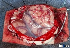 Tags: brain, cool, mark, question, scare, surgery, week, wtf (Pict. in My r/WTF favs)