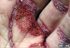 Tags: boy, needle, sews, skin, woman, wtf (Pict. in My r/WTF favs)