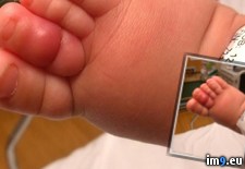 Tags: amputates, babies, hair, happe, psa, small, syndrome, tiny, toes, tourniquet, twisted, wtf (Pict. in My r/WTF favs)