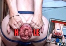 Tags: perverted, cunt, gay, prolapse, wide, assgape, analprolapse, gape, gaped, dickless, destroyed, fag, anal, hardcore, prolapsed, horny, porn, analgape, loser, faggot (Pict. in Faggot Jackeager2)