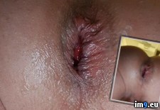 5dUzgaqq (#Gay #Fag #Faggot) - 114 KB Tags: fag, faggot, gay (Pict. in Fariss Von Rundstedt)