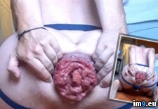 Tags: hardcore, gay, gape, prolapse, assgape, perverted, prolapsed, loser, cunt, destroyed, fag, faggot, horny, porn, gaped, analprolapse, anal, wide, ass, dickless, analgape (Pict. in Faggot Jackeager2)