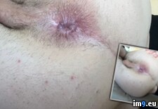 Tags:  (Pict. in Mattia Paolini exposed faggot)