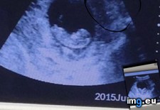 Tags: baby, chilling, demon, picture, shows, ultrasound, unborn, watching (Pict. in Alternative-News.tk)