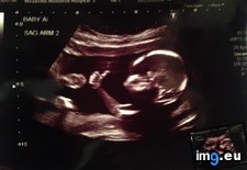 Tags: funny, good, result, ultrasound (Pict. in My r/FUNNY favs)