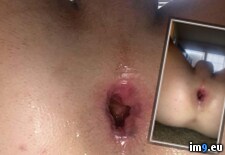 Tags: anal, analgape, assgape, asshole, bottom, buried, cock, dreaming, feeling, gape, gaped, gapedass, gay, gayanal, gayanalgape, gaygape, hole, huge, little, tight, twink, wide, young (Pict. in Gay Gape)