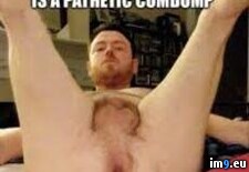 Tags:  (Pict. in Penectomy Joseph Ray Lee)