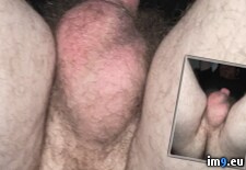 Tags:  (Pict. in Penectomy Joseph Ray Lee)