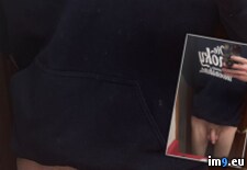 Tags:  (Pict. in Penectomy Joseph Ray Lee)