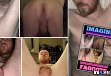 Tags:  (Pict. in Penectomy Joseph Ray Lee)