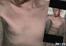 Tags: blackmail, dickless, exposed, fag, faggot, gay, joseph, lee, penectomy, ray (Pict. in Dickless and Horny Faggot Joseph Ray Lee)