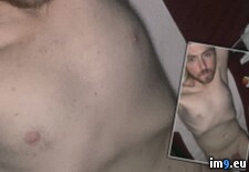 IMG_7999 (#Gay #Exposed #Fag #Penectomy #Lee #Joseph #Blackmail) - 215 KB Tags: blackmail, dickless, exposed, fag, faggot, gay, joseph, lee, penectomy, ray (Pict. in Dickless and Horny Faggot Joseph Ray Lee)