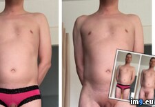 Tags:  (Pict. in Jan Klein, Zähringer Straße 12, 79108 Freiburg, Germany - Medartis GmbH)