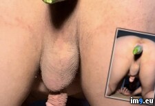 Tags:  (Pict. in Jan Klein, Zähringer Straße 12, 79108 Freiburg, Germany - Medartis GmbH)