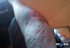 Tags: allergic, lines, reaction, tattoo (Pict. in My r/MILDLYINTERESTING favs)
