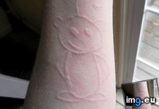 Tags: ago, dermatographia, developed, forearm, inexplicably, months, snoo (Pict. in My r/MILDLYINTERESTING favs)